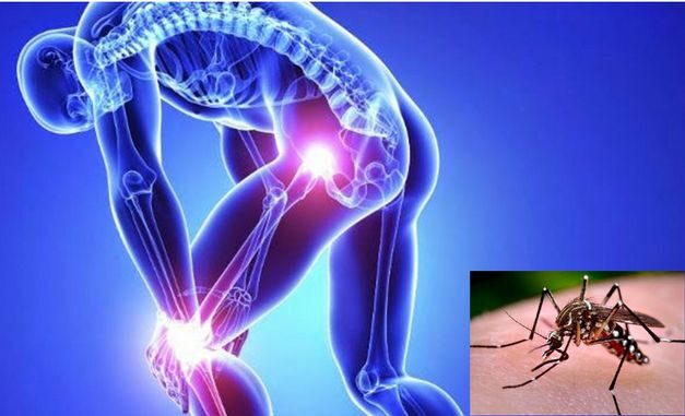 chikungunya-aqueles-que-se-dobram-dores-articulares-incapacitantes-1663686